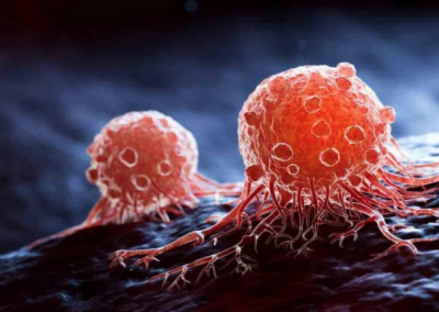 Europa, 5% con diagnosi da cancro