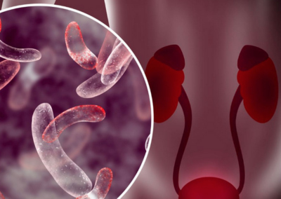 Pembrolizumab e Enfortumab combinati modificano la storia dei tumori uroteliali