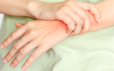 Rischio di cancro incidente e uso di inibitori del fattore di necrosi tumorale (TNFi), non-TNFi o inibitori della Janus chinasi (JAKi) in pazienti con artrite reumatoide?