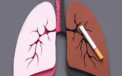 Il valore della cessazione tabagica nei pazienti oncologici