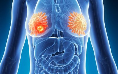 Studio AMEERA-3: Il Ruolo di Amcenestrant nel Carcinoma Mammario Avanzato ER-Positivo, HER2-Negativo