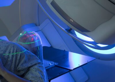 Confronto tra radioterapia ipofrazionata e radioterapia convenzionale