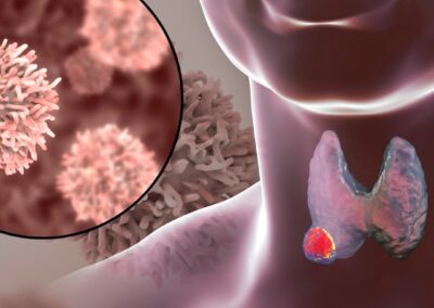 Il ruolo del cetuximab dopo immunoterapia nei tumori squamosi della testa e del collo recidivati/metastatici dopo immunoterapia: una domanda ancora senza risposta