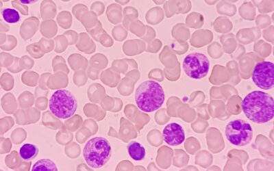 Medical Imaging and Pediatric and Adolescent Hematologic Cancer Risk