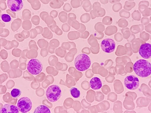 Medical Imaging and Pediatric and Adolescent Hematologic Cancer Risk