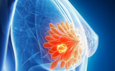 Comprehensive analysis of the systemic immune landscape across breast cancer subtypes and disease stages