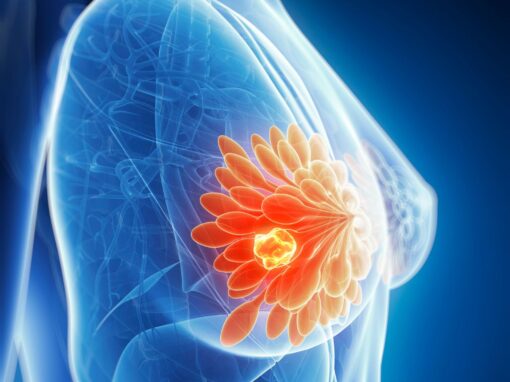 Comprehensive analysis of the systemic immune landscape across breast cancer subtypes and disease stages
